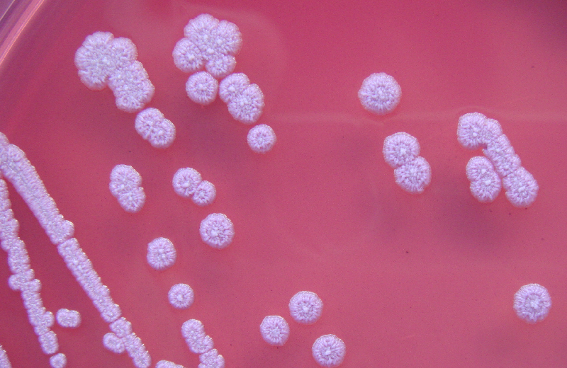 melioidosis