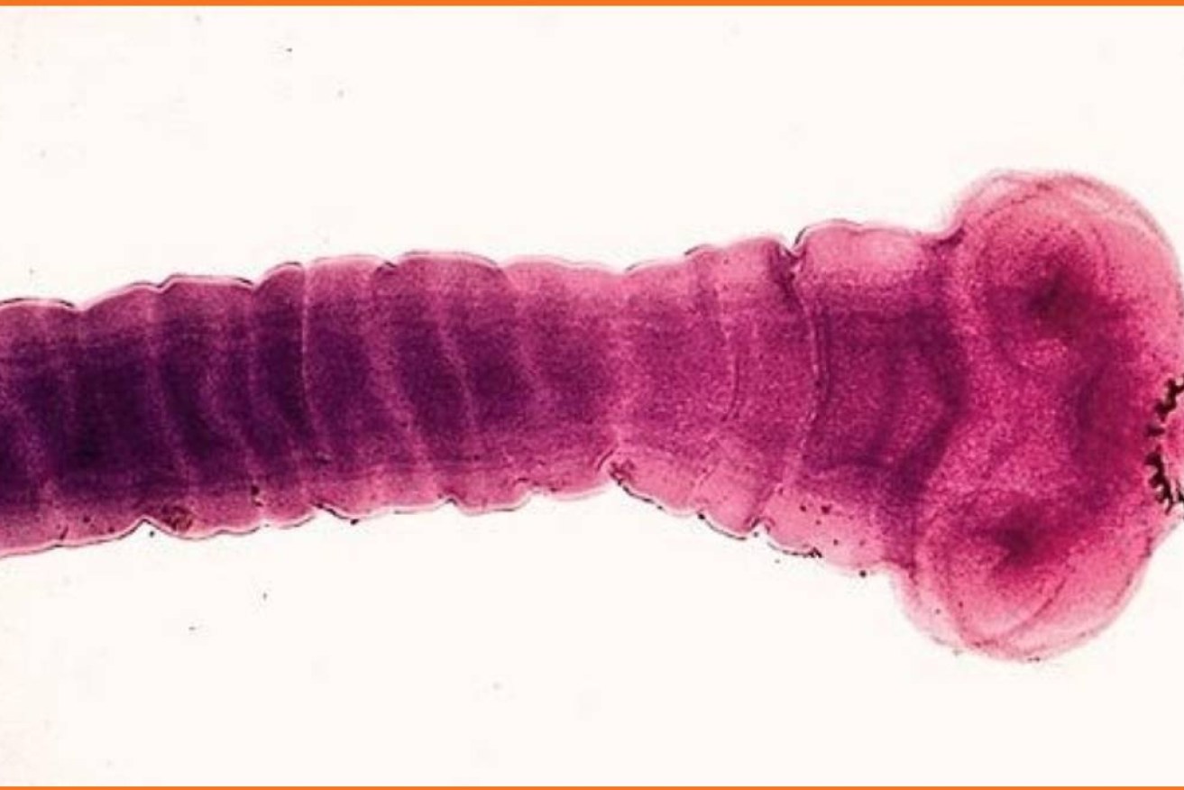 Pork can carry taenia solium larvae, a parasitic tapeworm.