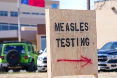 Second child dies in US measles outbreak