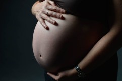 Botch sees woman give birth to stranger's baby