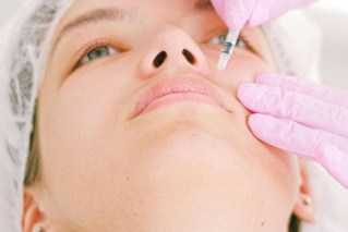 The hidden health risks of lip fillers
