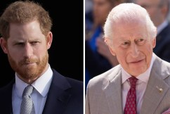 Freshly bruised Harry’s startling reveal on father