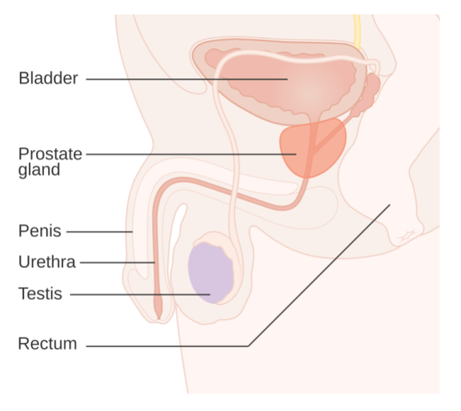 prostate cancer