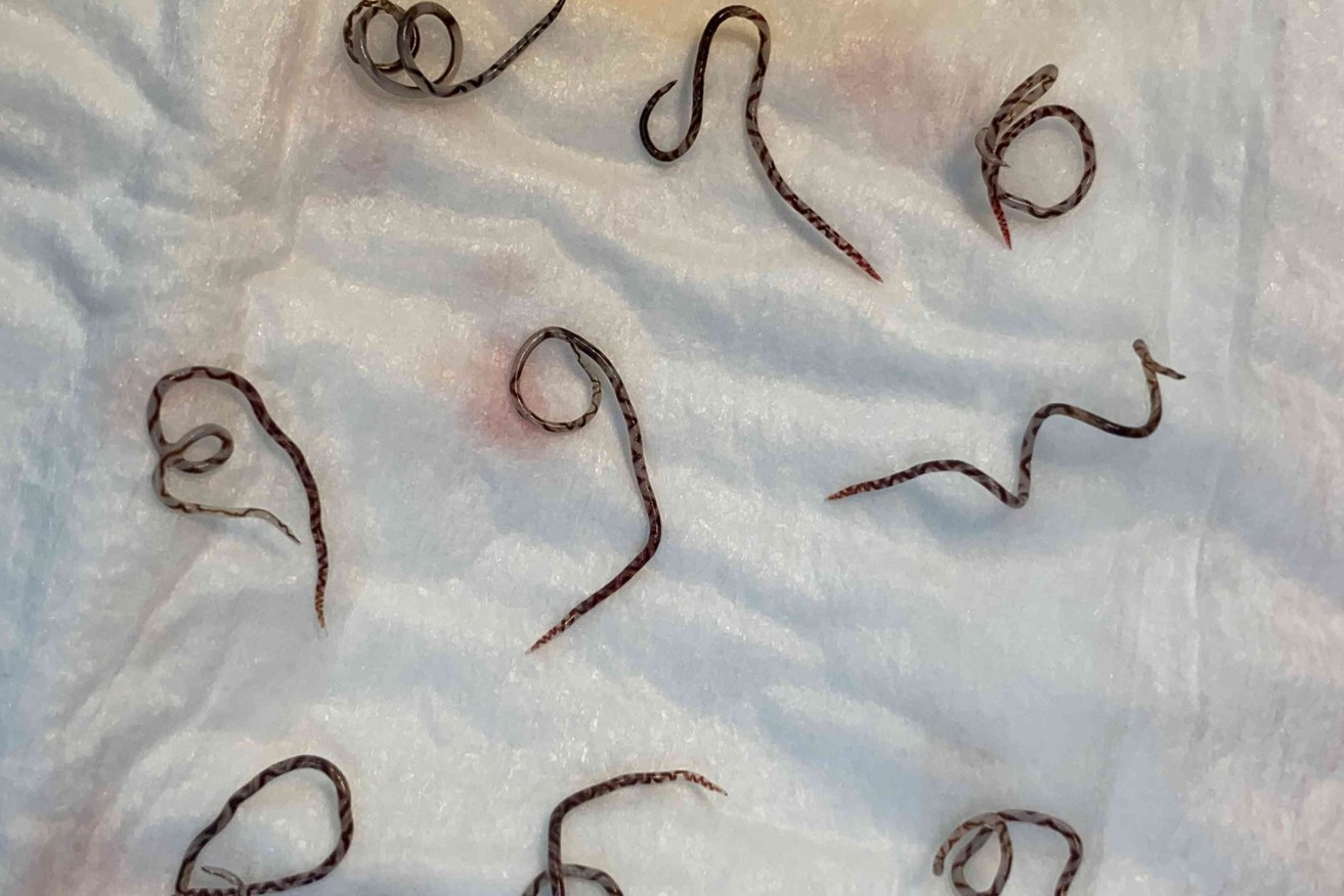 Rat lungworm has spread to Australia from Southeast Asia.