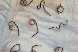 Aus warning of rise in savage lungworm disease 