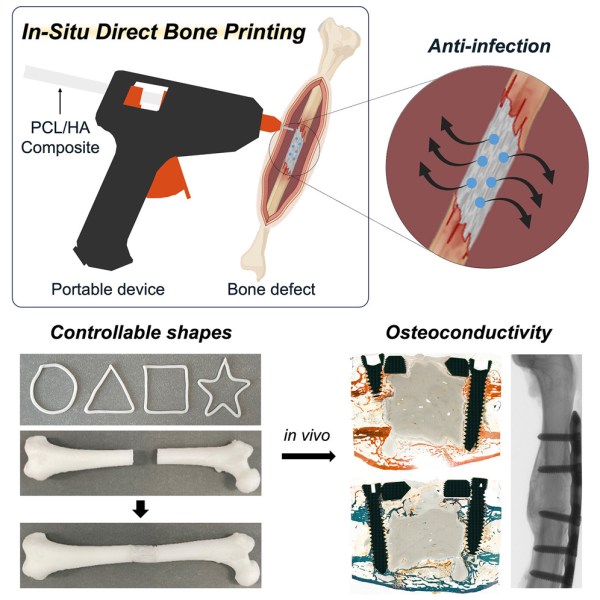 3d printing bones