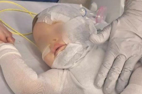 Chinese investigators hunt man who burnt Qld baby