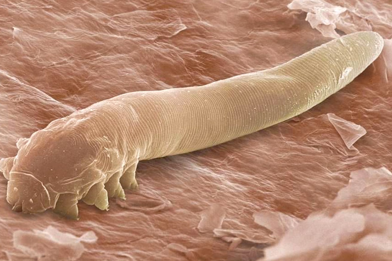 Demodex folliculorum mites: Our skin is alive with company.