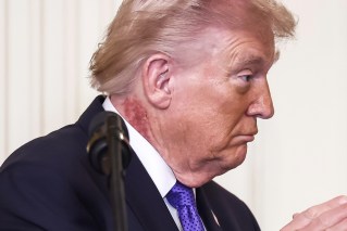 Rash on Trump's neck reignites health alarm