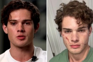 Inside the disturbing trend of ‘looksmaxxing’