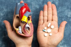 Hospital trials world-first cholesterol treatment