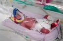 One in 15 million: Mum delivers rare quadruplets