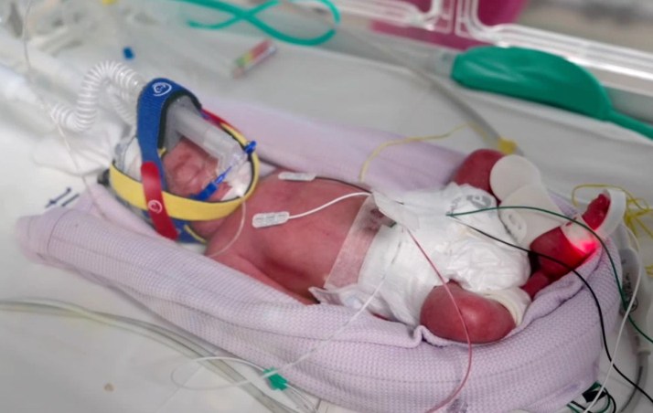 One in 15 million: Mum delivers rare quadruplets