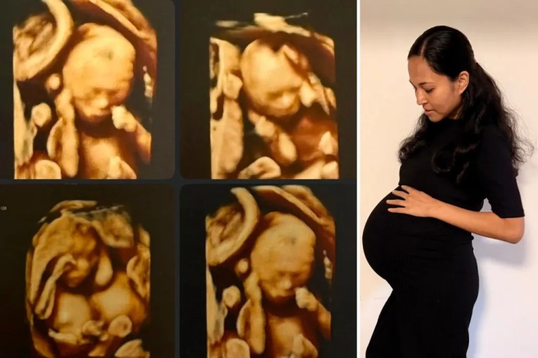 Parents of rare quadruplets double their brood