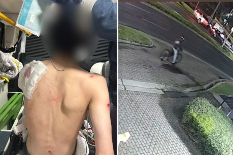 'Senseless': Teen hit with machete in e-bike theft