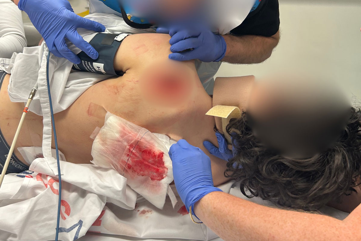 Wantirna attack