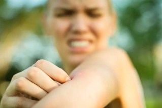 Why some people react so badly to mosquito bites