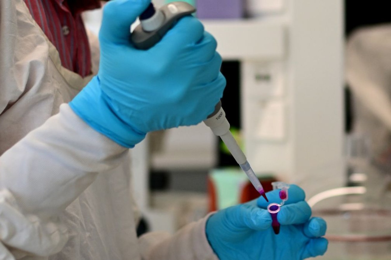 A study has found elevated rates of motor neuron disease in parts of western NSW.