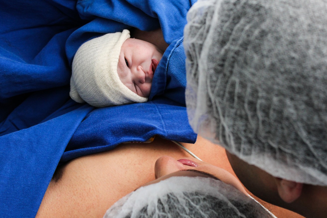 It is barbaric that some women in Australia are shackled when they give birth.