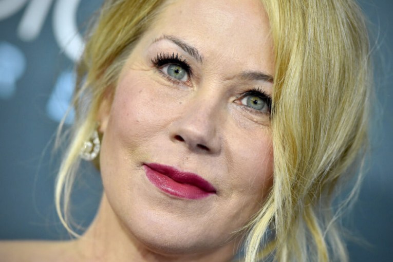 Christina Applegate's misdiagnosis is not uncommon