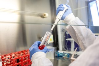 Trial aims to beat grim 'widow maker' heart attacks
